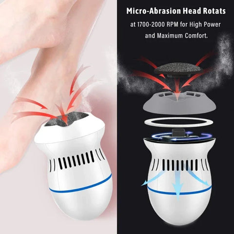 Electric Foot Dead Skin Remover